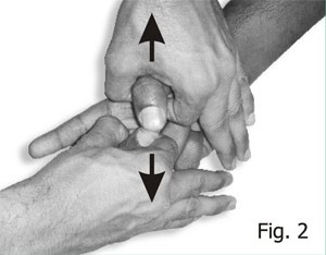 fig-2